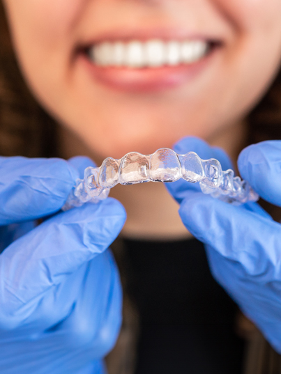 clear aligners